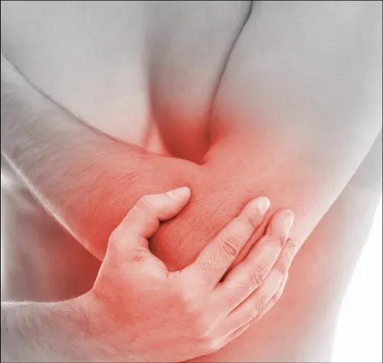 Arthritis